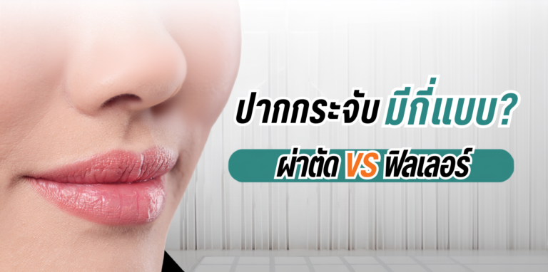 ปากกระจับมีกี่แบบ ผ่าตัดVSฟิลเลอร์