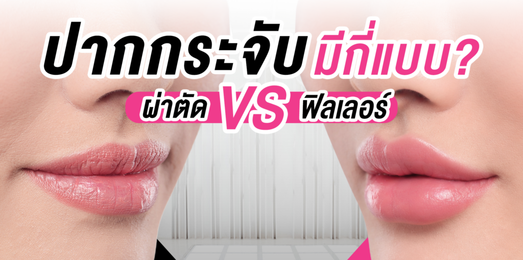 ปากกระจับ คืออะไร? มีกี่แบบ ต่างกันอย่างไร