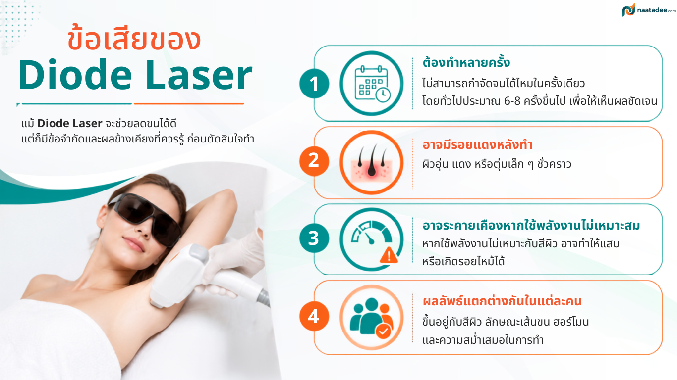 ข้อเสียของ Diode Laser