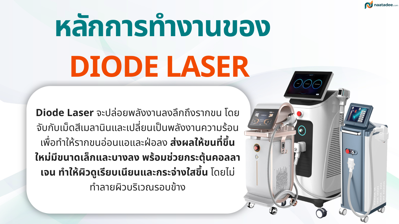 หลักการทำงานของ Diode Laser