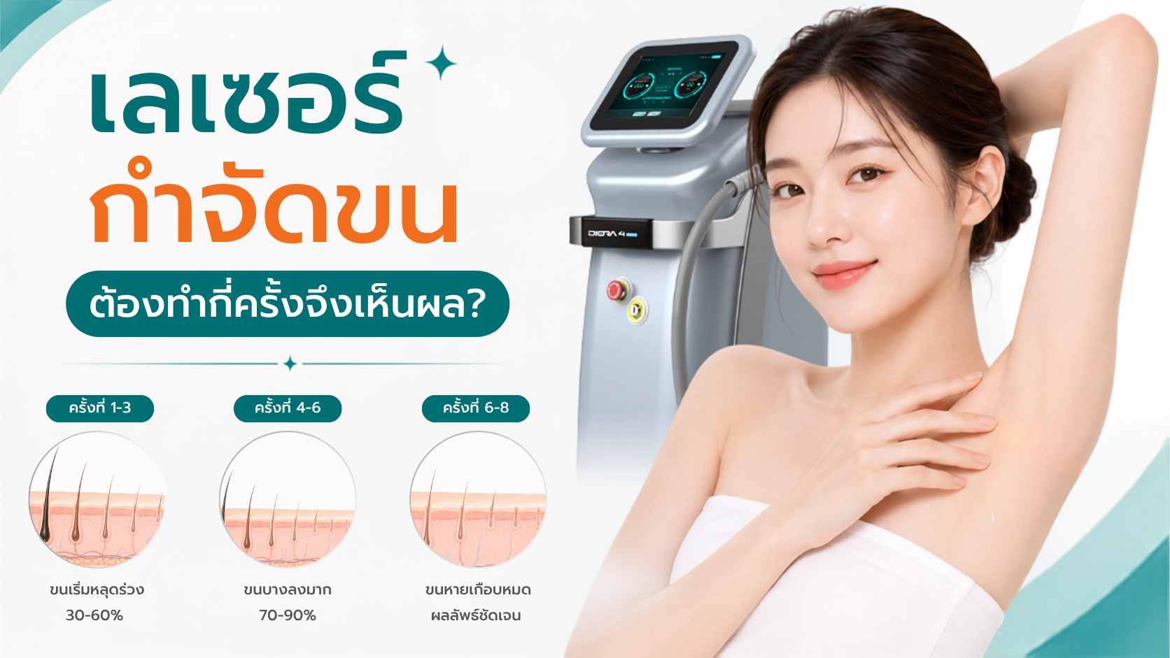 เลเซอร์กำจัดขนต้องทำกี่ครั้งถึงจะเห็นผล?