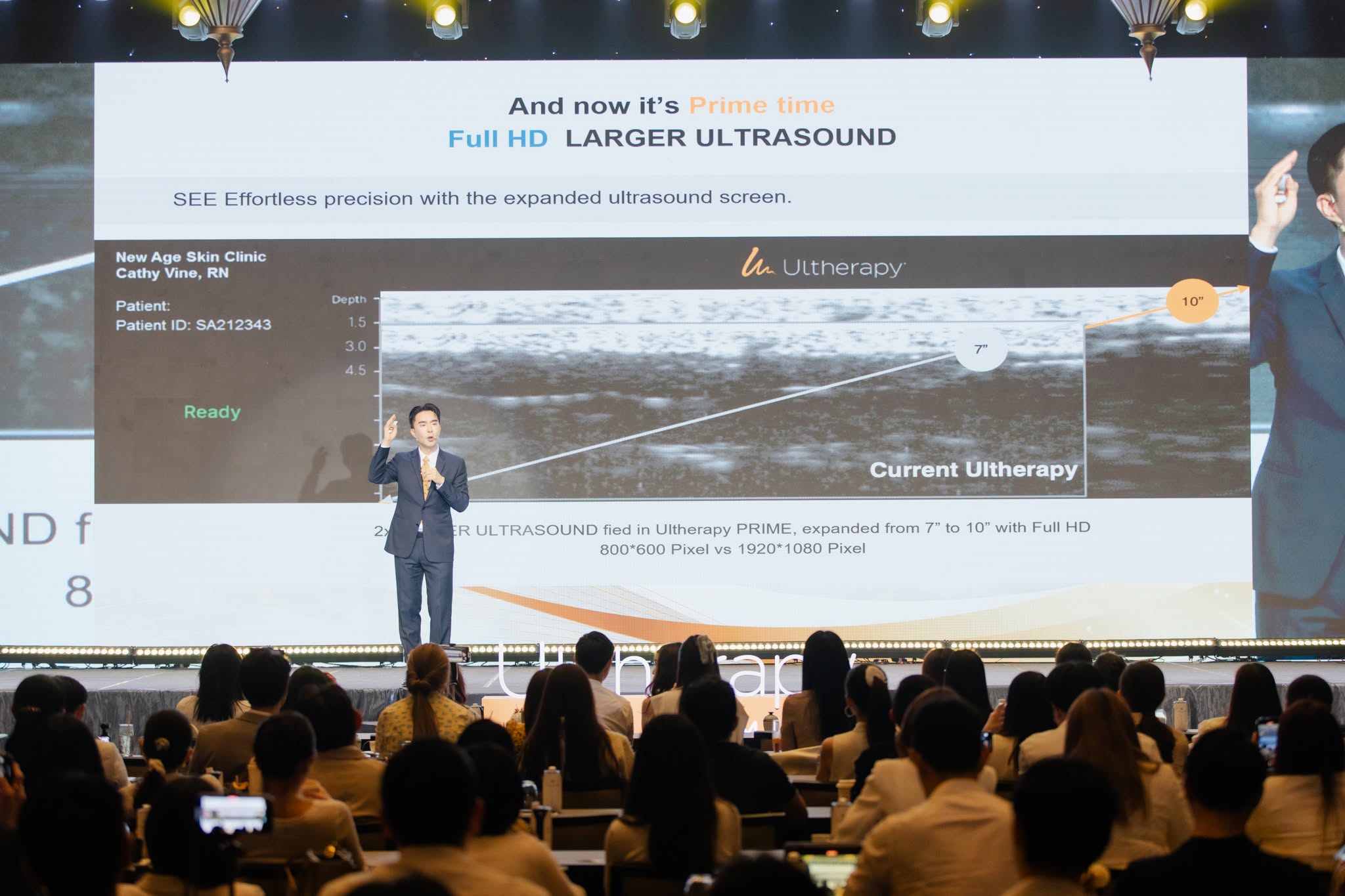 ภาพงานเปิดตัว Ultherapy Prime