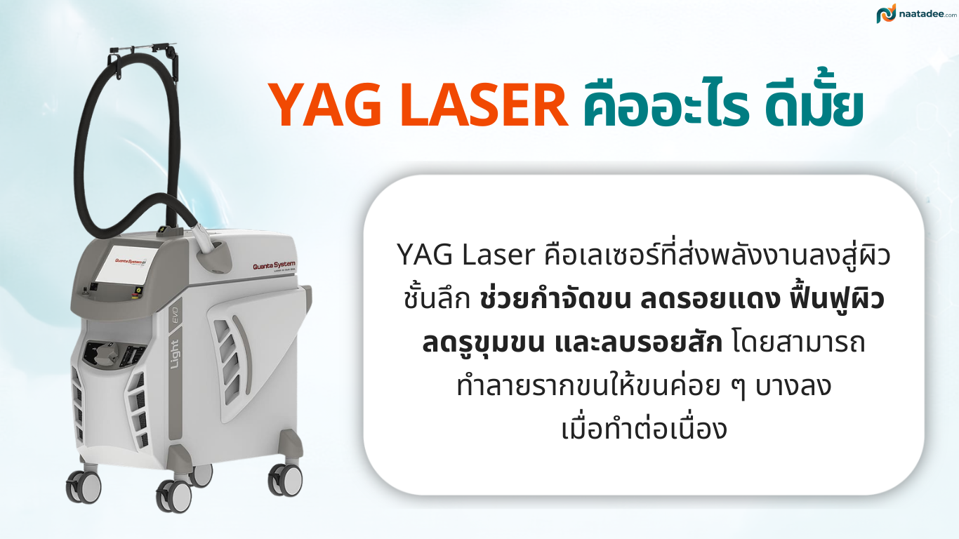 yag laser คืออะไร ดีมั้ย