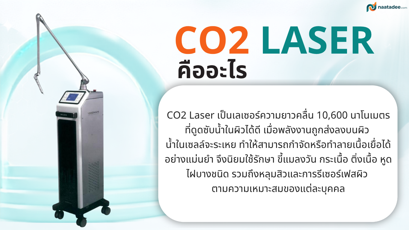 CO2 Laser คือ