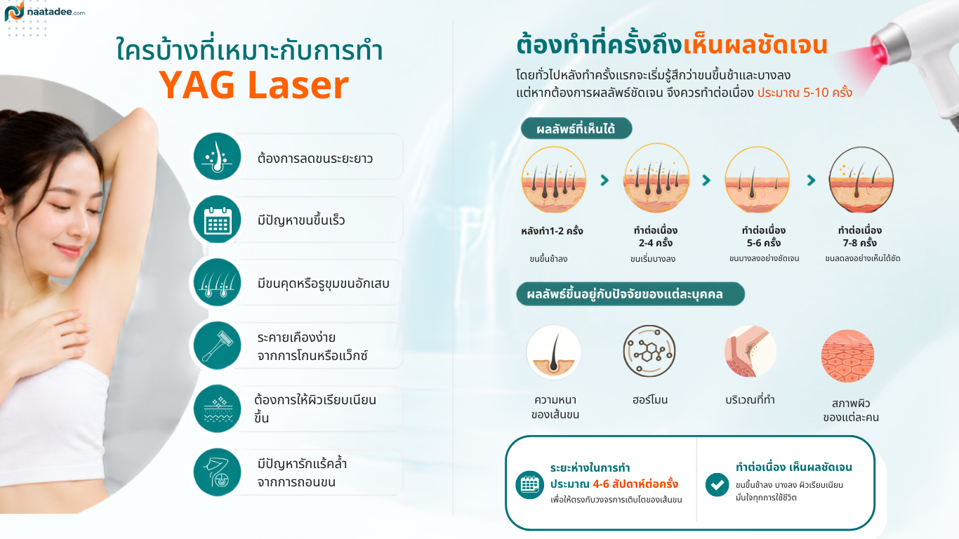 ใครบ้างที่เหมาะกับการทำ YAG เลเซอร์ และต้องทำกี่ครั้ง