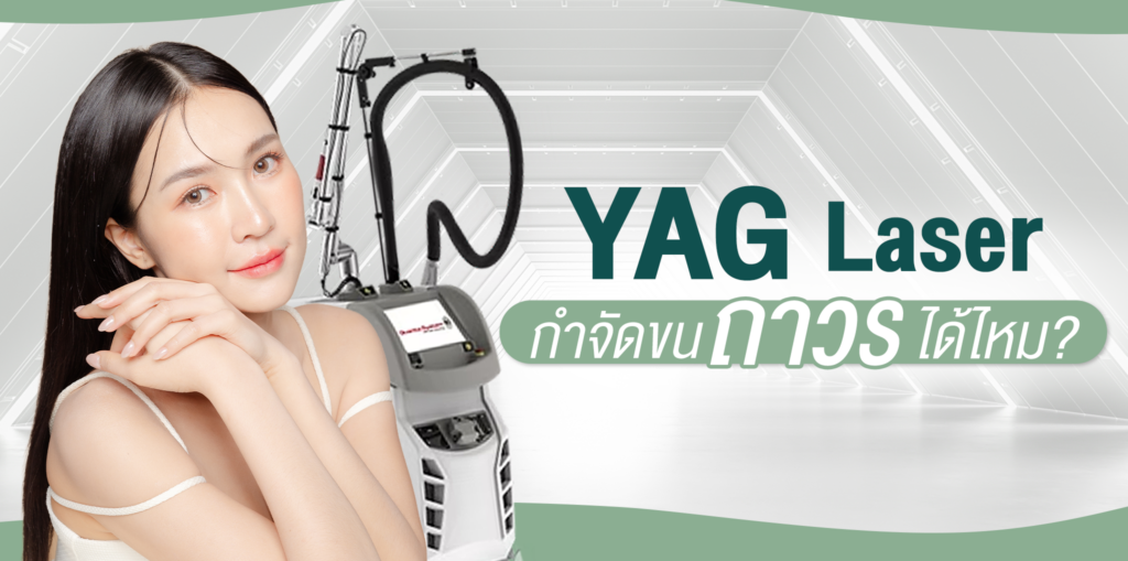YAG Laser กำจัดขนถาวรได้ไหม? เจาะลึกข้อดี ปัญหาผิวที่รักษาได้