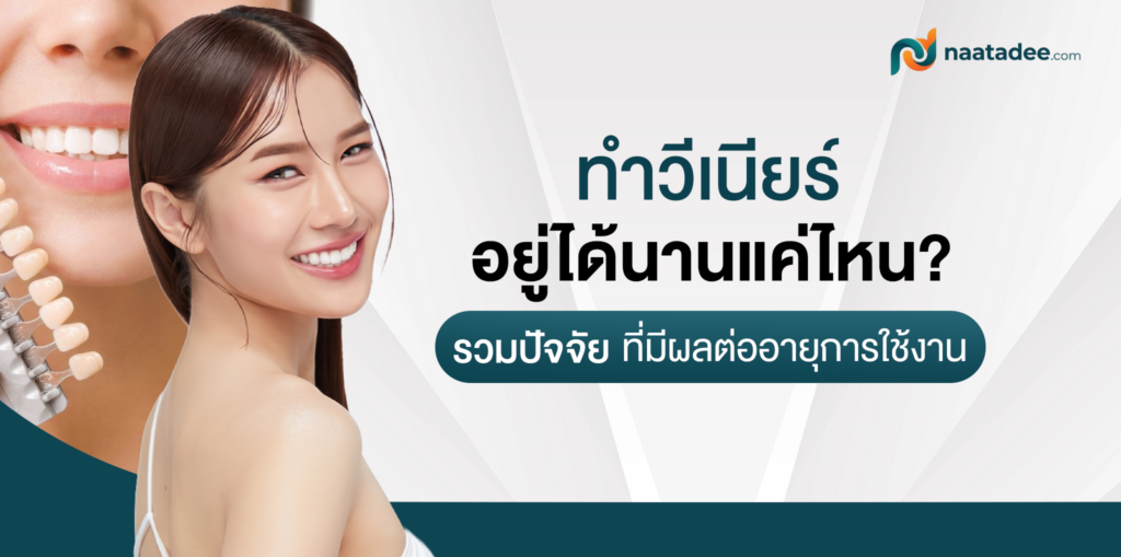 ทำวีเนียร์อยู่ได้นานแค่ไหน_ รวมปัจจัยที่มีผลต่ออายุการใช้งาน